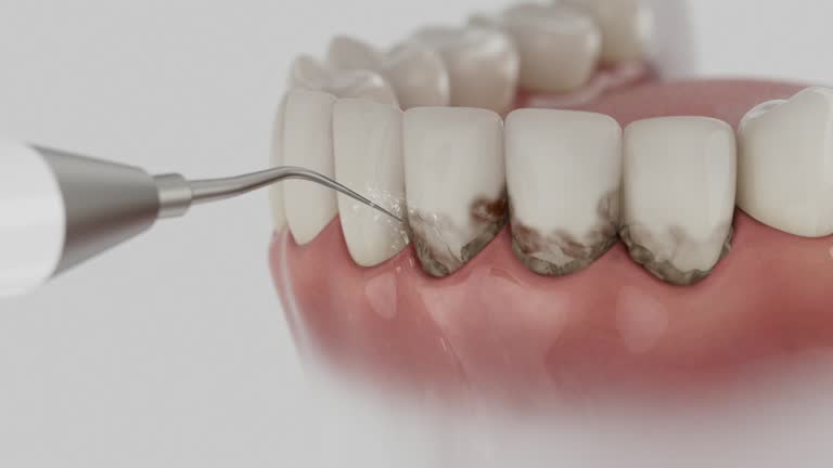 Reliable Dental contractor in Trabuco Canyon, CA by Dentist Open Now